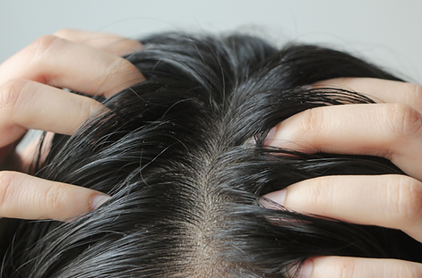 Read more about the article Scalp Health: Everything You Need To Know | Preity Prerna