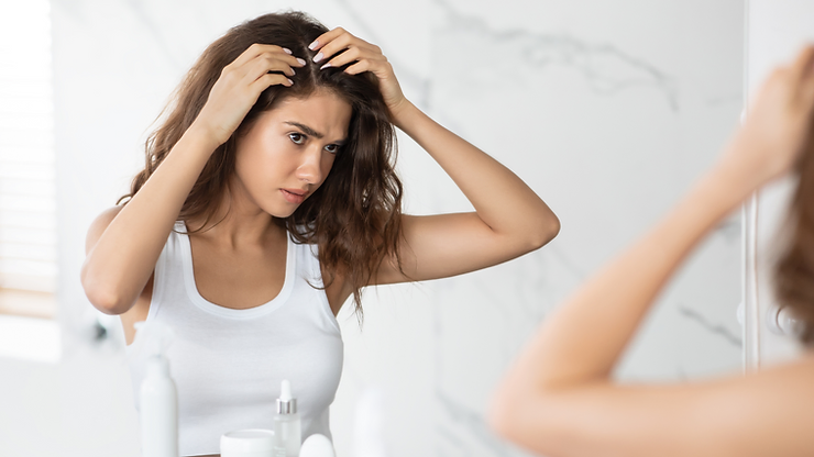 Read more about the article Understanding Causes Of Dandruff | Preity Prerna