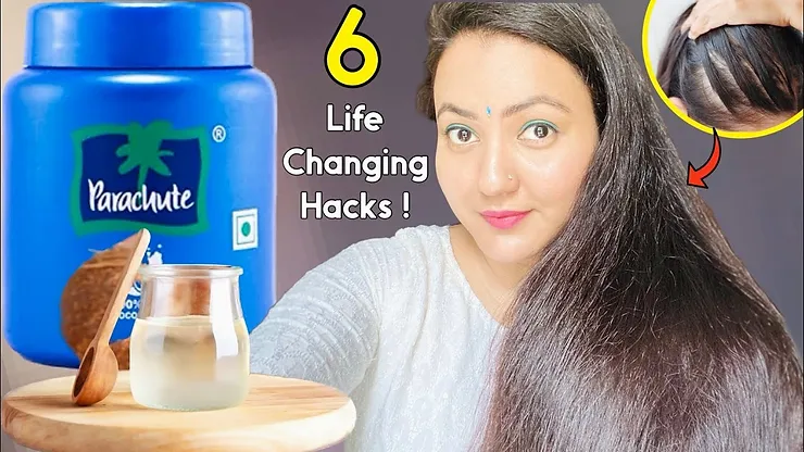 You are currently viewing 6 Hacks Of Coconut Oil | Preity Prerna