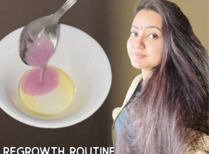 Read more about the article These 2 Natural Remedies Can Grow Your Hair | Preity Prerna