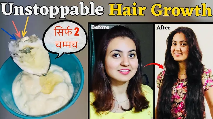 You are currently viewing This DIY Hair Tonic to Regrow Lost Hair | Preity Prerna