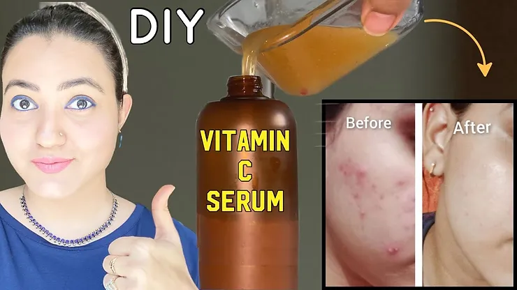 You are currently viewing How To Make Vitamin C Serum At Home?