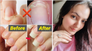 Read more about the article Home Remedy For Healthy Nails | Preity Prerna