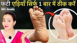 Read more about the article Best Home Remedy For Cracked Heels | Preity Prerna